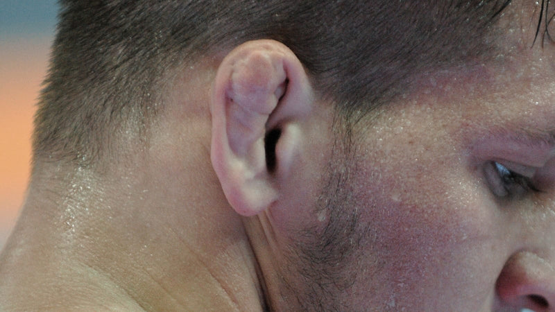 Fake Cauliflower Ear Surgery Is Trending in Russia — Men Are Paying $80 Per Ear to Look Like Grapplers Without Touching a Mat